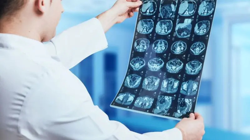 SEO for Radiologists in Leeds Increase Patient Enquiries