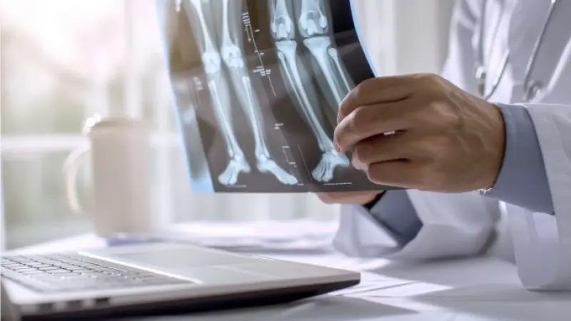 SMO  for Interventional Radiologists in Leeds