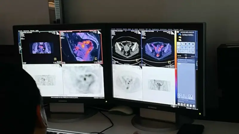 Digital Marketing Service for Interventional Radiologists Leeds