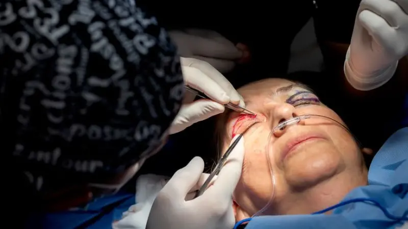 Most Popular Dermatologist in London