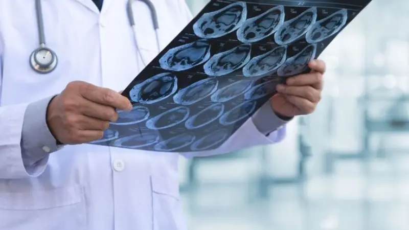 Most Popular Neurologist in London