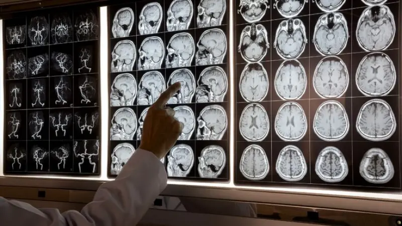 Top Rated & Most Reliable Neurologist in London