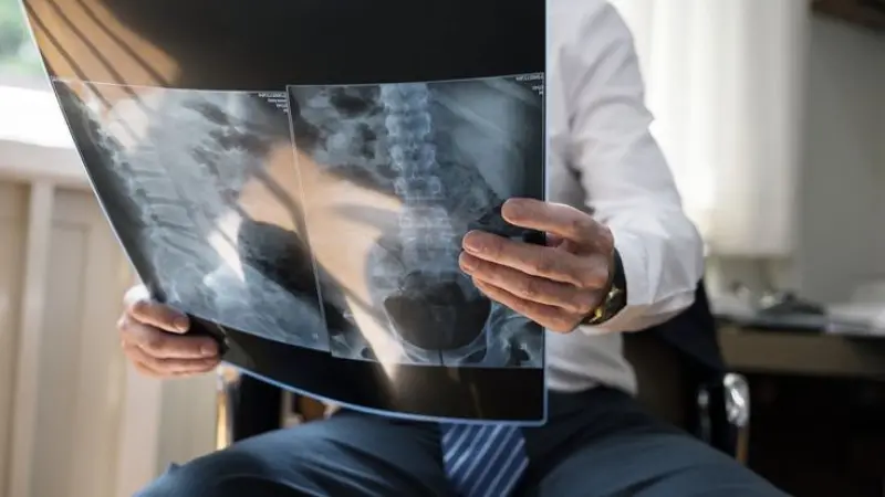 Top Rated & Most Reliable Rheumatologist in London