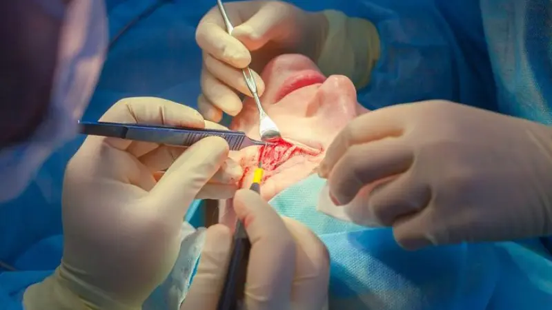 Website Development for Plastic Surgeon London