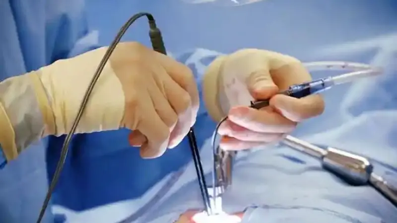 Content Marketing for Vascular Surgeon in London