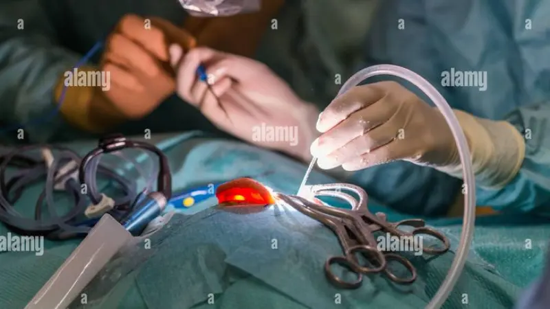 SEO for ENT Surgeon in Londo