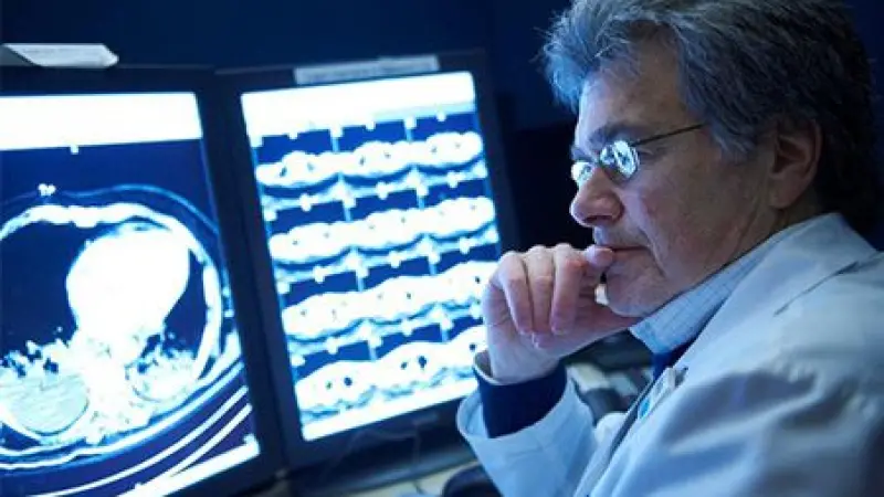 Email Marketing for Radiologist in London