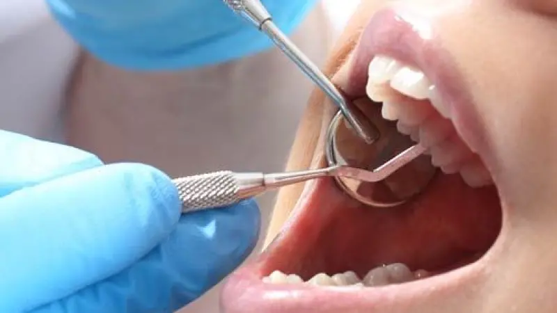 Website Development for Dentist in London