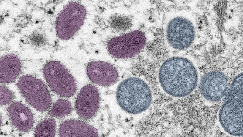 New recombinant mpox strain detected in UK and India, WHO urges continued monitoring