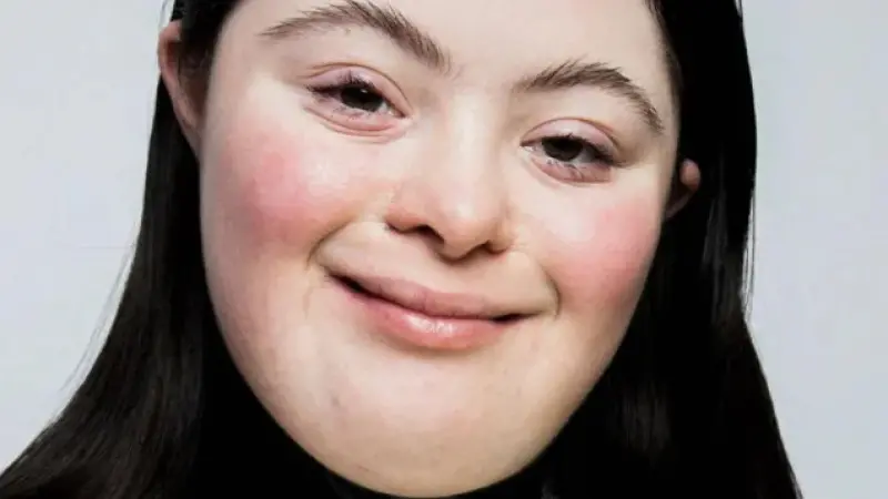 Ellie Goldstein: The Down Syndrome Model Redefining Beauty as the New Face of Gucci Beauty